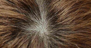 Best Hair loss Treatment 2024