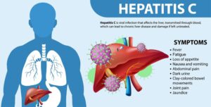 Complications of Hepatic Parenchymal Disease