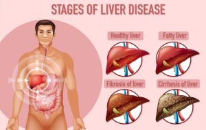 Causes of Hepatic Parenchymal Disease 