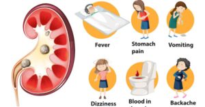 Symptoms and signs of kidney stones