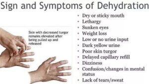 Signs and Symptoms of Dehydration