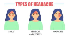 Types of Headaches to Track in Your Chart