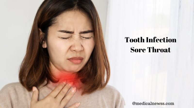 "Tooth Infection Sore Throat: An untreated tooth infection is known to cause throat pain. Go to the dentist in order to avoid further issues.”