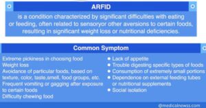  Celiac Disease is Just a Food Allergy